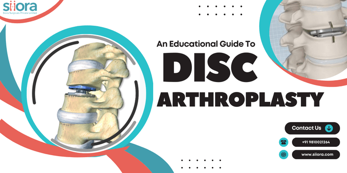 An Educational Guide to Disc&nbsp;Arthroplasty