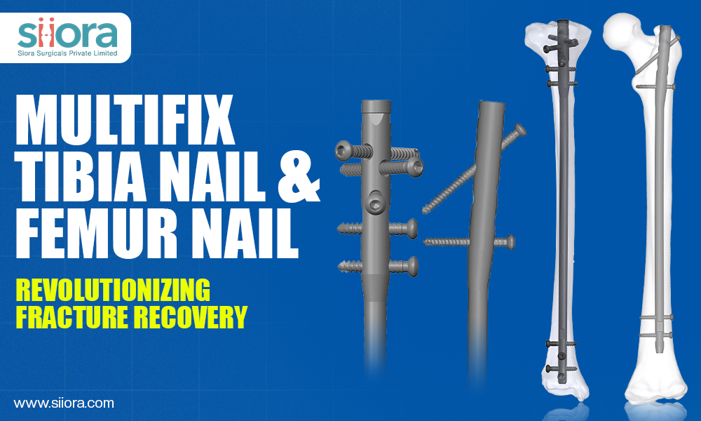 Multifix Tibia Nail and Femur Nail